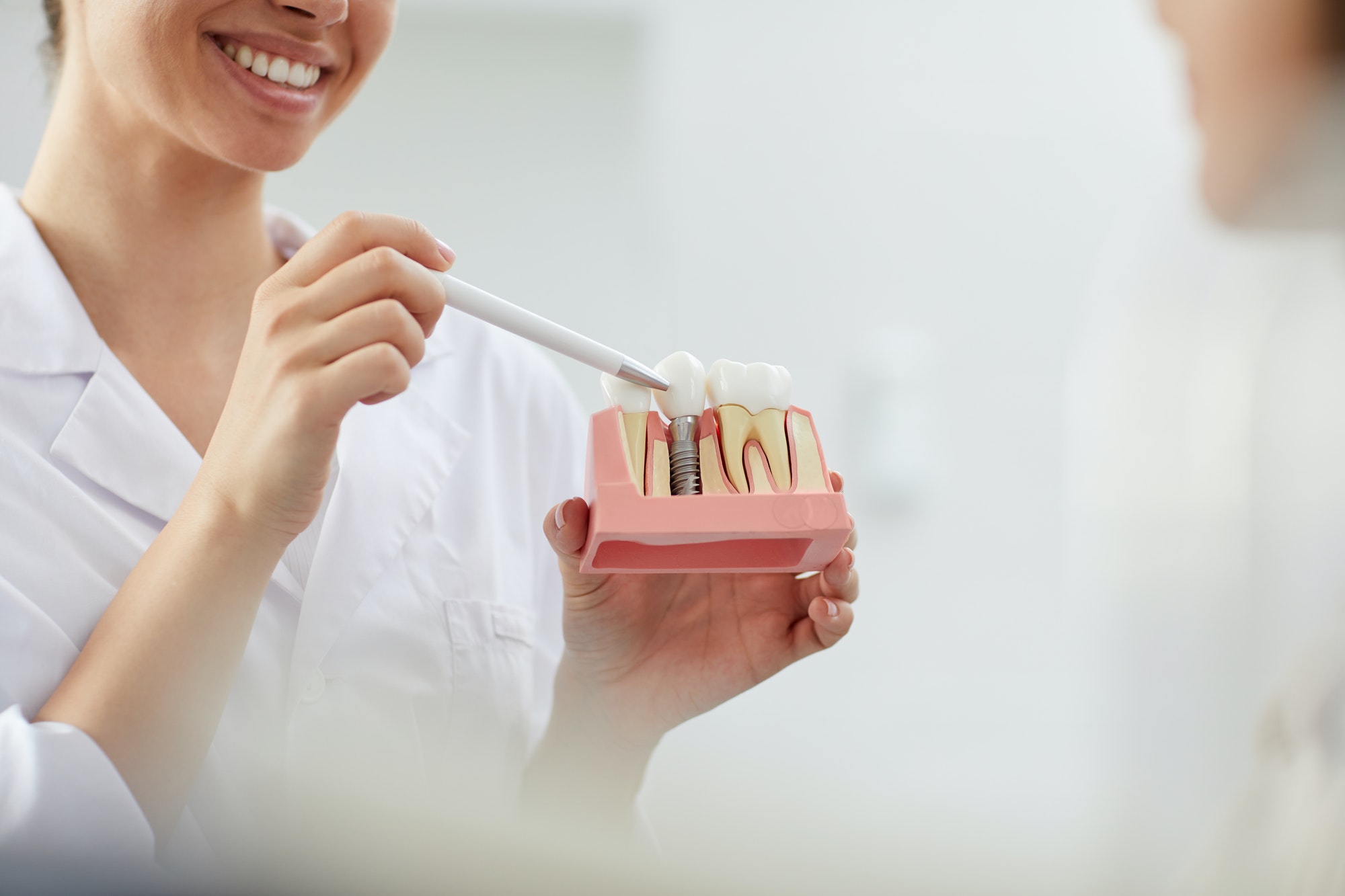 Dentista explicando el procedimiento de un implante dental